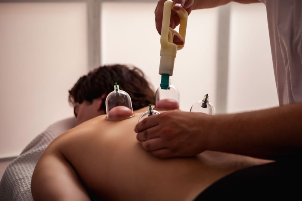 Seance therapie des ventouses