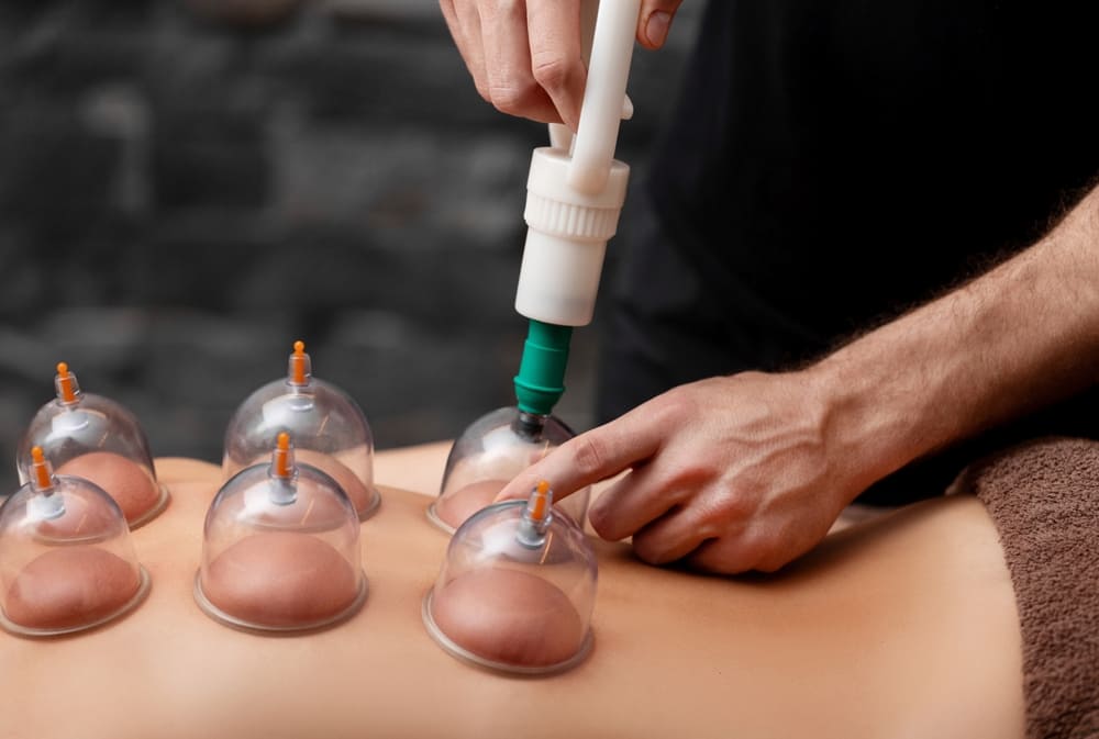 séance montrant le thérapie des ventouses à paris