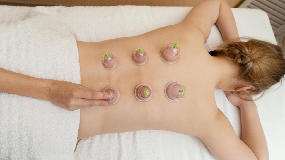 technique des ventouses thérapeutiques ou cupping thérapie